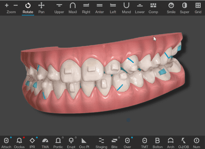 Align Technology unveils new version of its ClinCheck treatment planning  software - Channel Post MEA